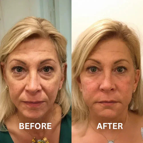 Vitala™ Insta Firm – Instant Eye & Lid Lift